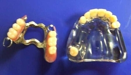 rencontre quelqu’un avec des dents manquantes