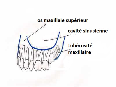 Tubérosité Du Maxillaire Supérieur — Conseil Dentaire Dr.Hauteville